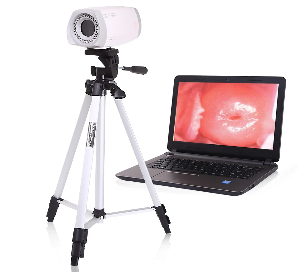 Portable digital colposcope