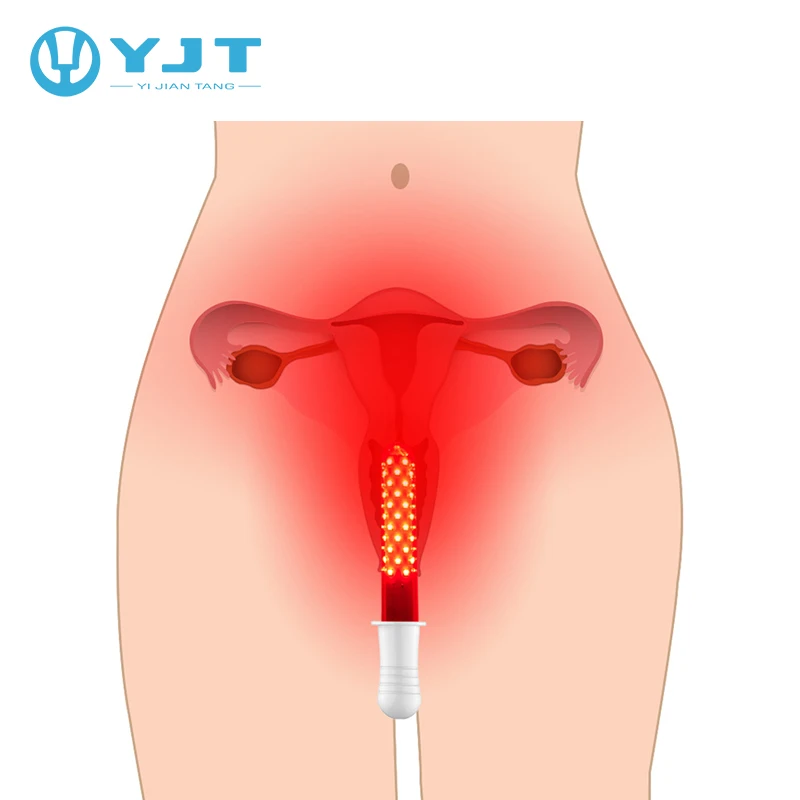 Гинекологическое сочетание синего и красного света лазерное противовоспалительное вагинальное Терапевтическое Медицинское Устройство