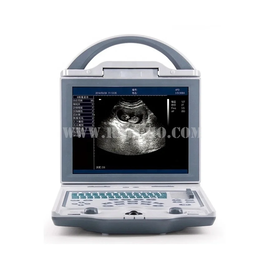 Mindray DP-10 B/W Ultrasound Machine Laptop Ultrasound Scanner Machine for Human