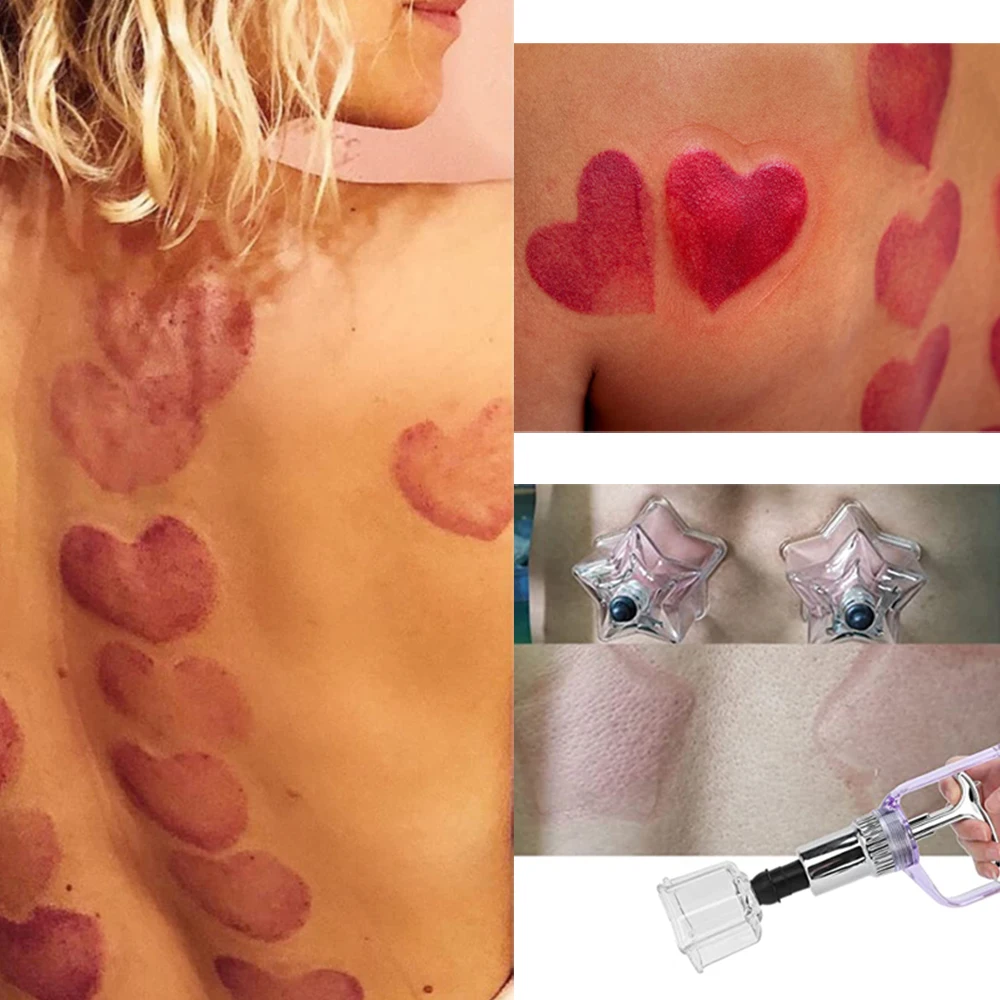 10Pcs Star Shaped Cupping Cups Plastic Vacuum Therapy Set Cupping Kit Massager with Box