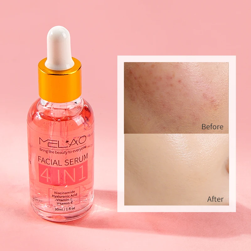 MELAO Anti Wrinkle Brightening Face Serum Skin Repair NIACINAMIDE VITAMIN C E Hyaluronic Acid 4 In 1 Skin Care Serum