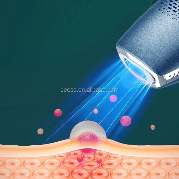 hair removal laser device DEESS GP591 ipl hair removal device at home hair removal device in laser
