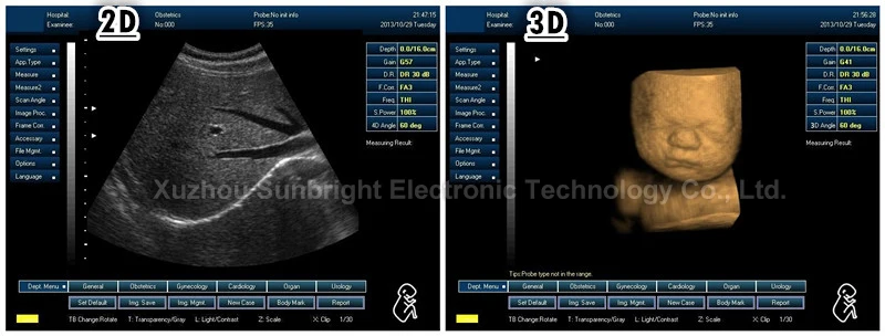 hot selling 3D ultrasound system USG equipment veterinary portable ultrasound scanner