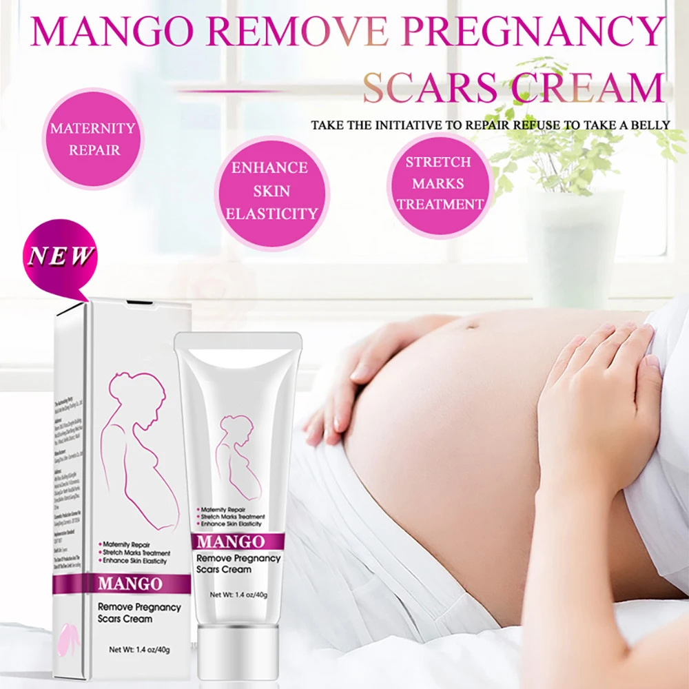 RtopR Mango Remove Pregnancy Stretch Mark Repair Scar Cream Factory Outlet