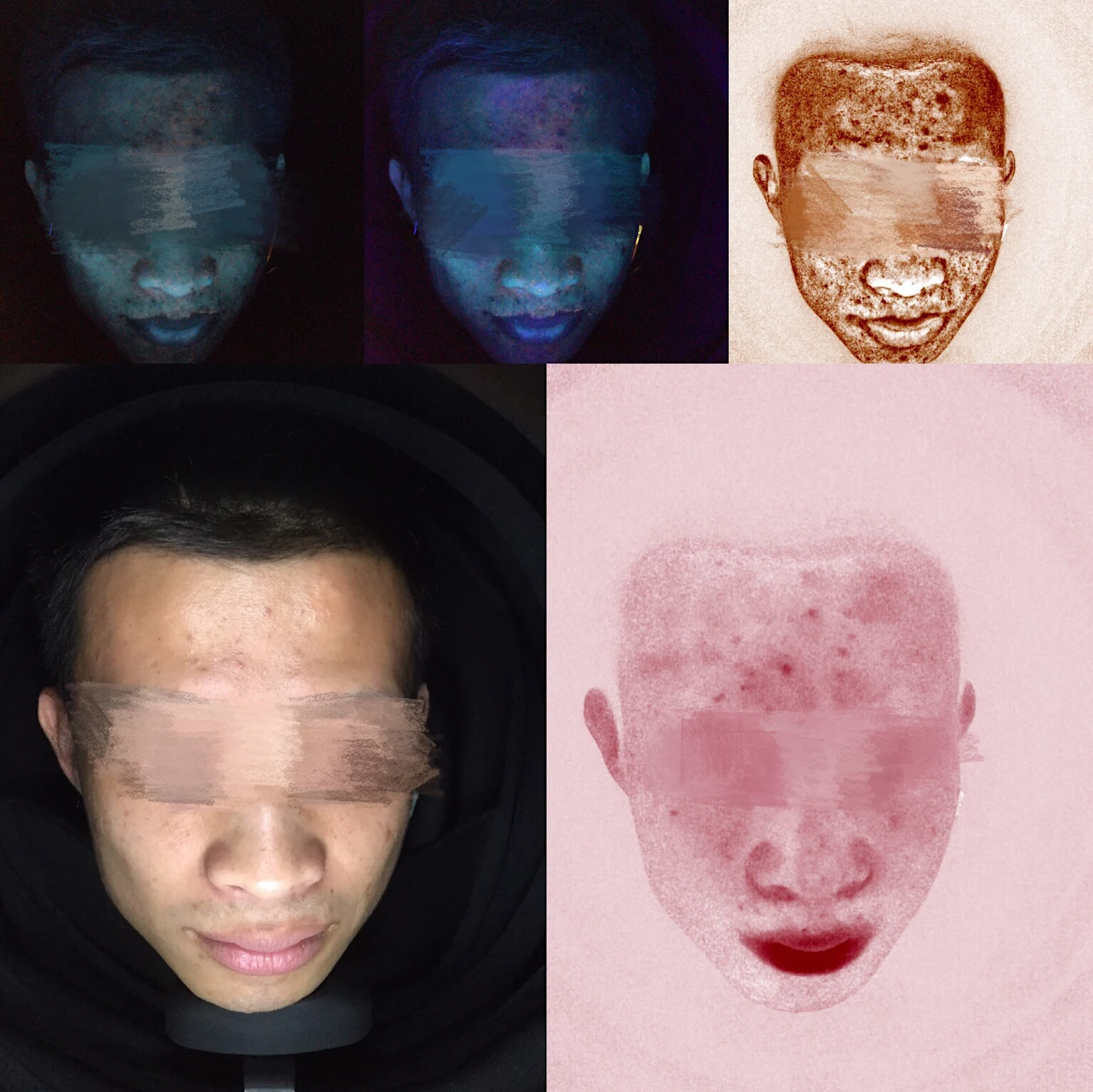 2023 Newest Skin Tester Professional Observe Diagnostic Scanner DE Cloud Storage Skin Detector