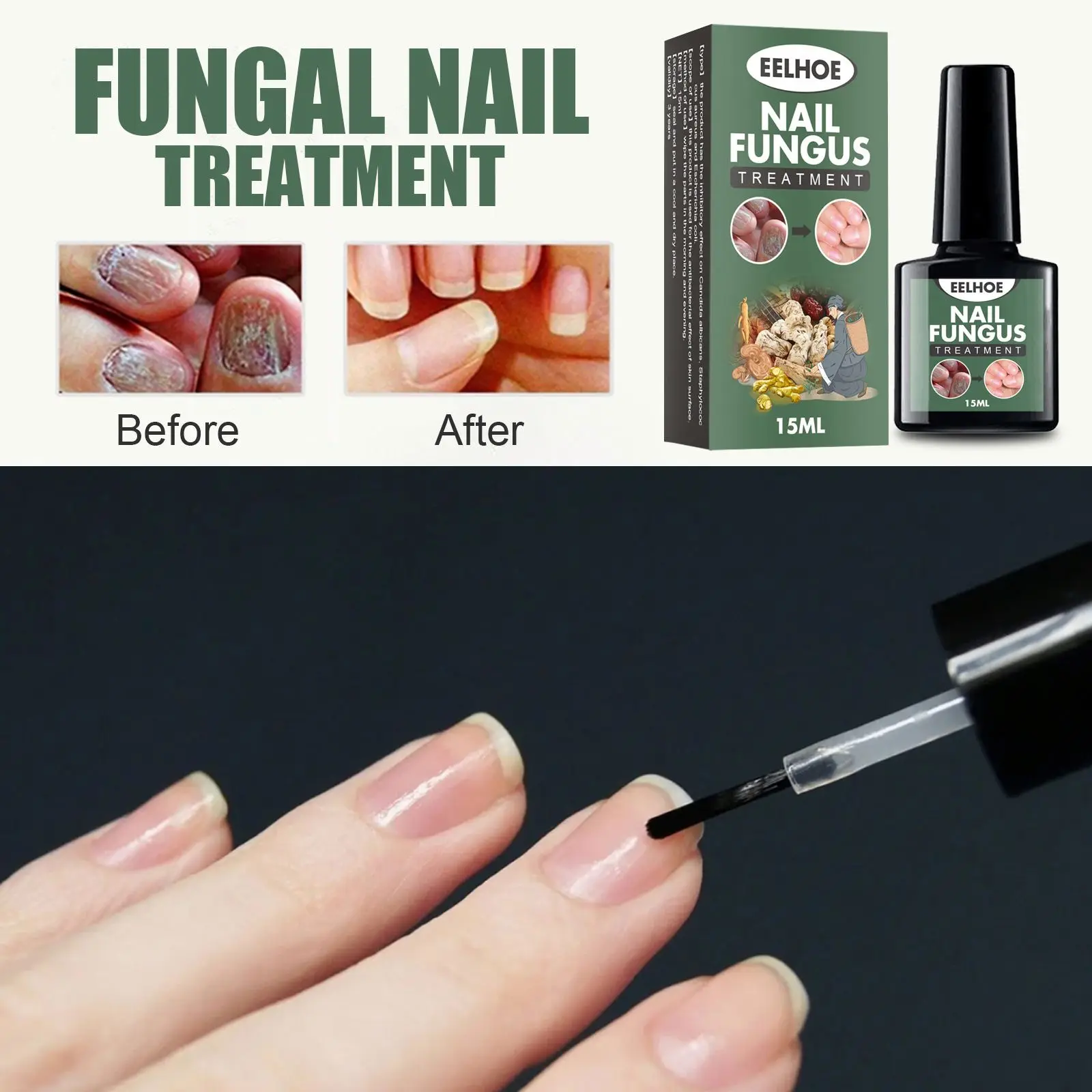 Costom Nail Repair Liquid Solution Fungal Nail Antifungal Anti Fungus Toe Nail Care Hand and Foot Onychomycosis Care