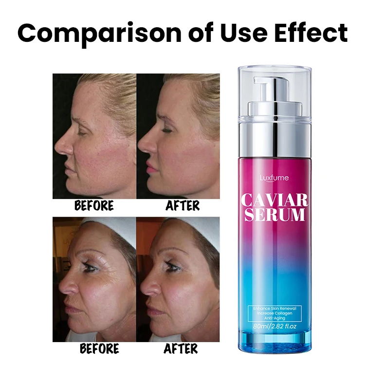 Black Caviar Niacinamide Hydrating Anti-Aging Skincare Serum Caviar Serum