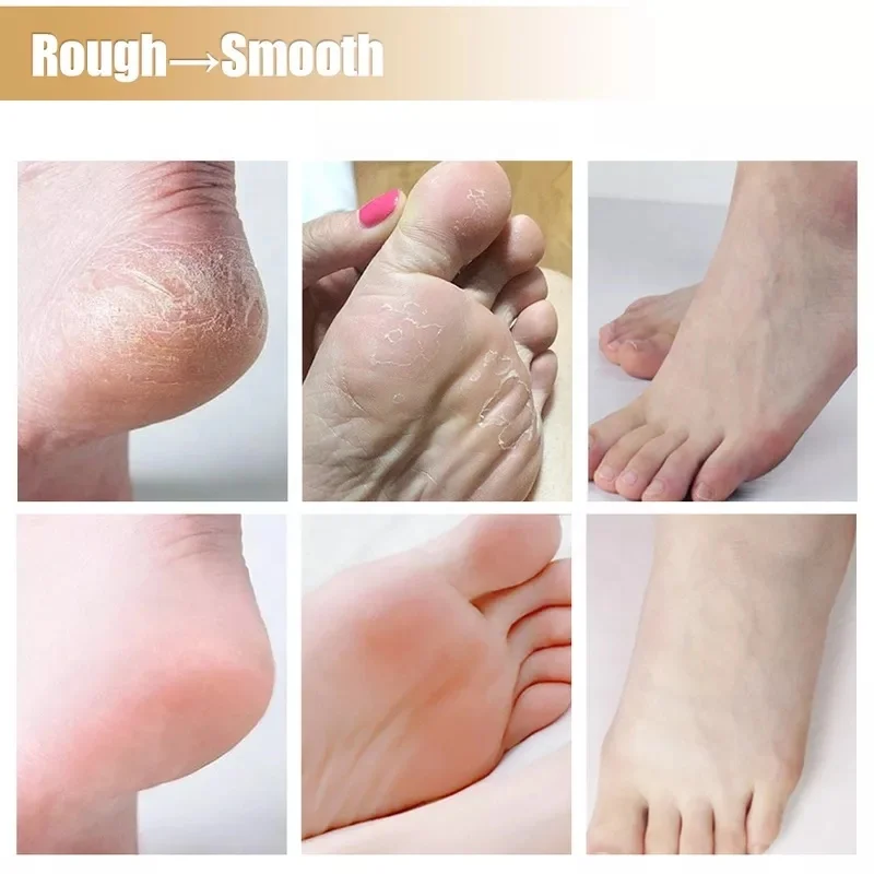Anti Crack Foot Cream Heel Cracked Repair Horse Oil Cream Smooth Removal Dead Skin Callus Anti-Drying Hand Feet Skin Care 30g