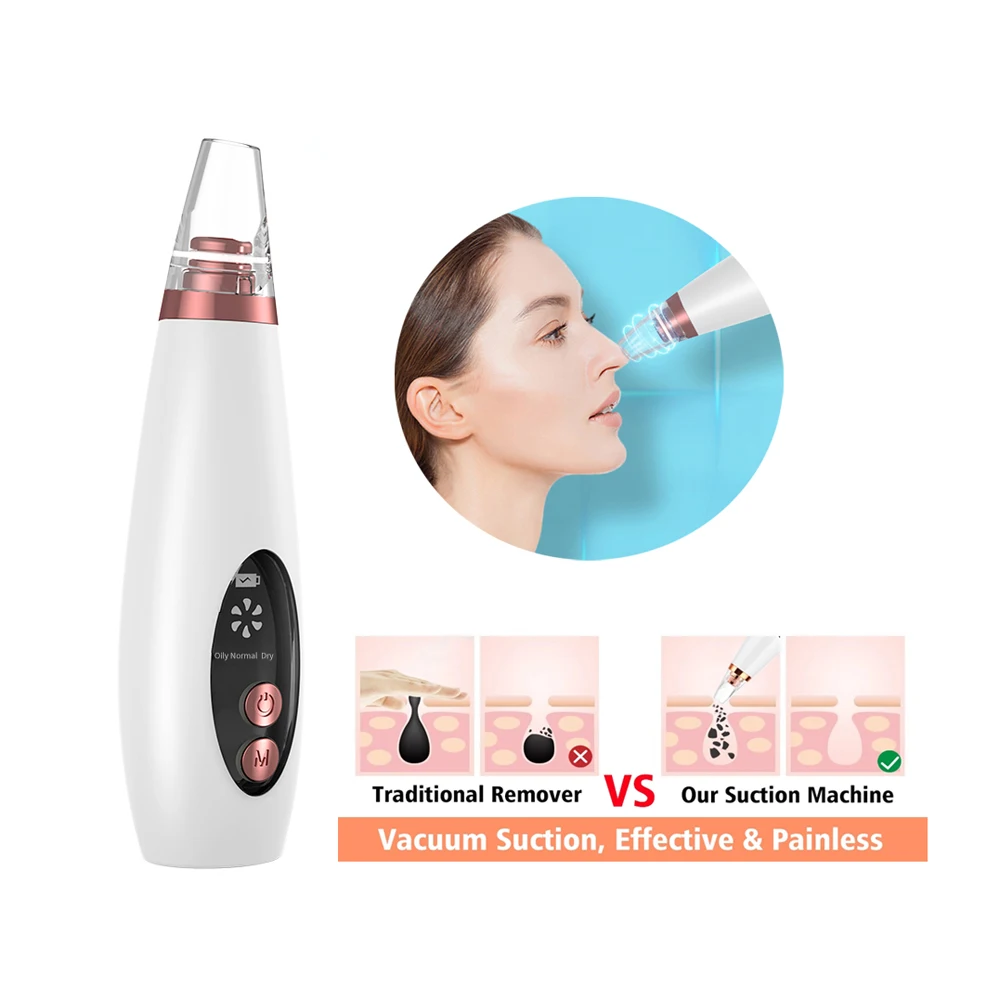 Private Label Portable Electric Facial Skin Care Pore Cleaner Black Head Removedor De Cravos Acne Blackhead Remover Vacuum