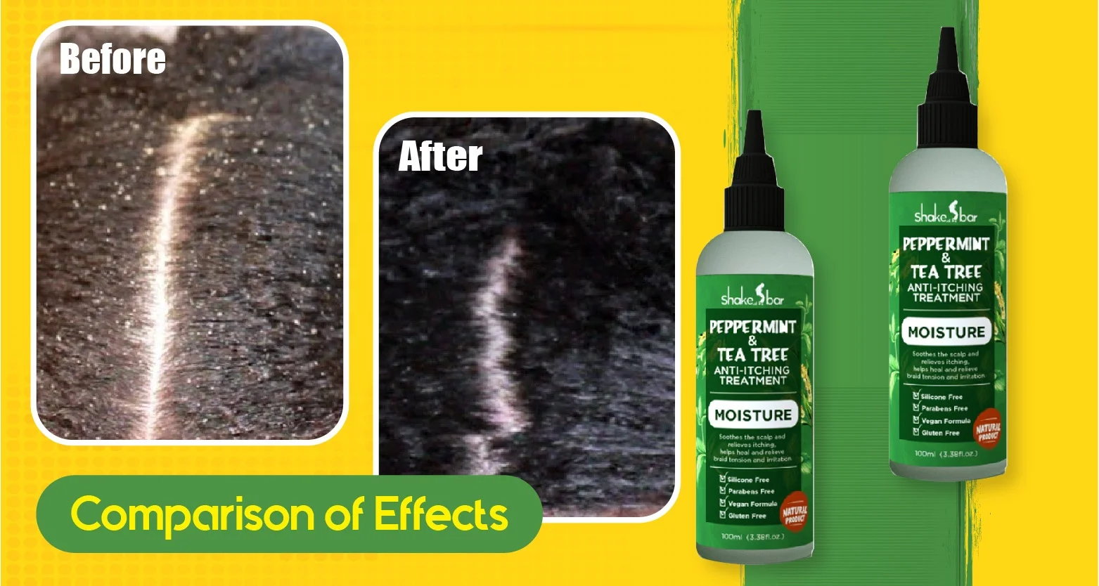 
private label products Peppermint & Tea Tree Anti-itching Treatment Customized product professional hair care 