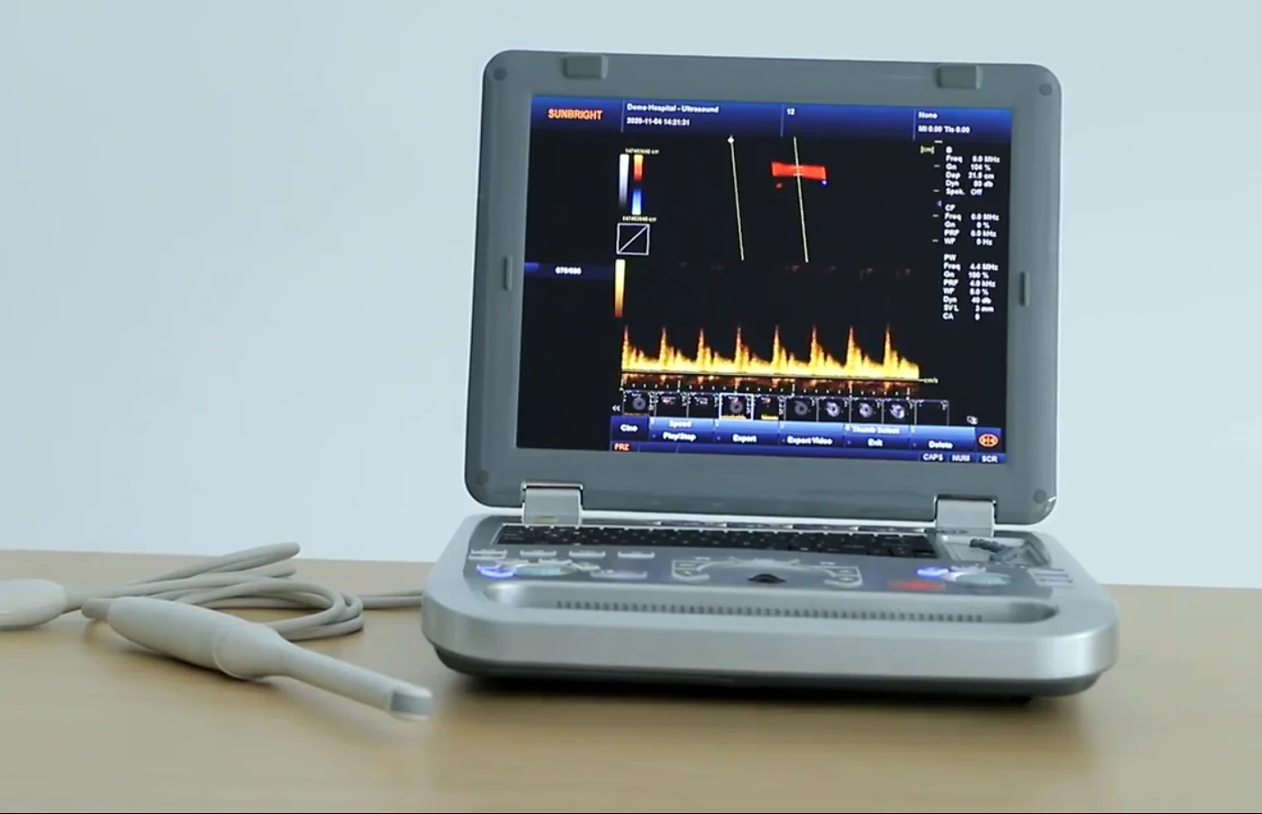 SUN-906B Portable Color Doppler scan High-end Rectal probe Veterinary ultrasound for pig sheep cattle goat