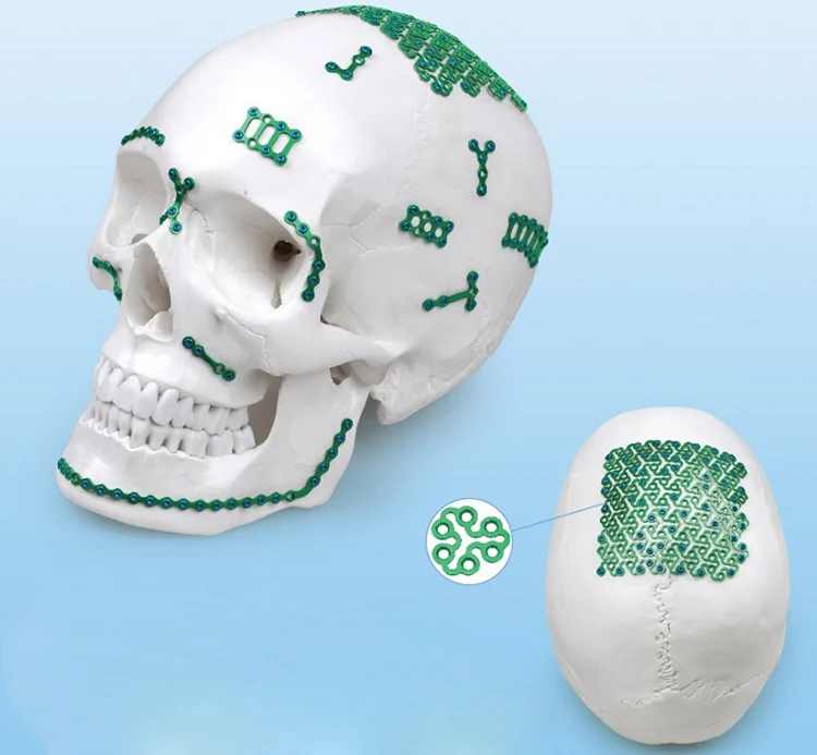 Wall Mounted Surgical Led Medical Operating Light Ceiling-mounted Shadowless Led Operating Lamp Examination Light