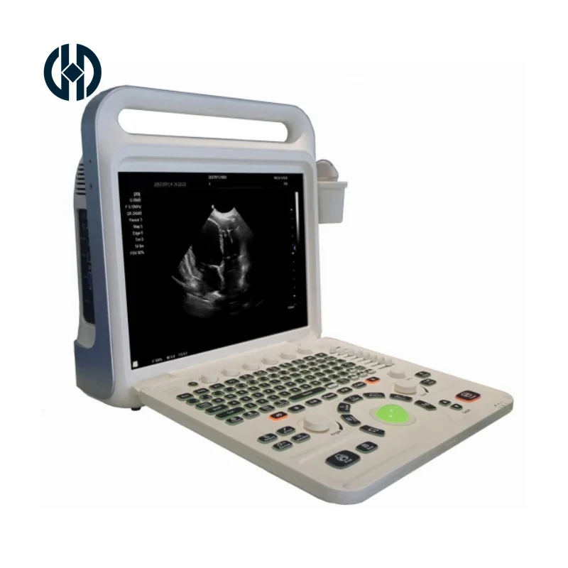 Best quality portable color doppler ultrasound equipment 3d 4d echo machine High Resolution with trolley