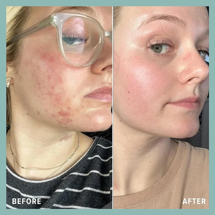 ETRUN ALISA Private Label Vitamin E Cleansing Balm Refreshing and non-greasy makeup removal for face eyes mouth