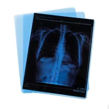 Medical X-Ray Thermal Film CT Scan 14x17inch x Ray Film Medical Film For Agfa Drystar 5302