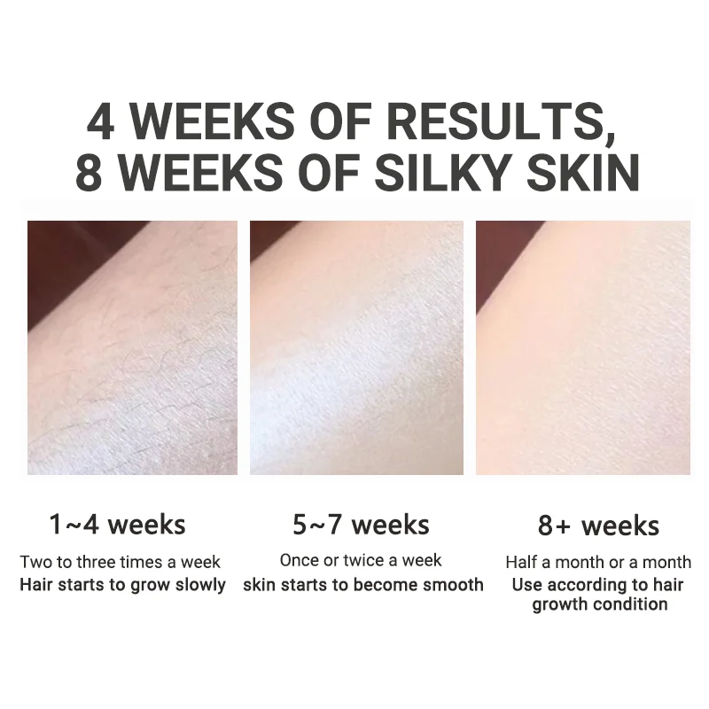 Intense Pulse Home Personal Whole Body Hair Removal Arm Armpit Painless Ipl Laser Hair Removal Device