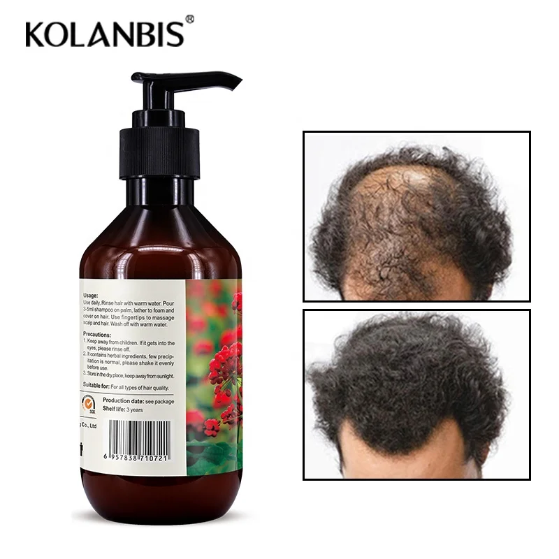 KOLANBIS Biotin Shampoo Strengthen Hair Follicles Hair Care Line Treatment Hair Growth