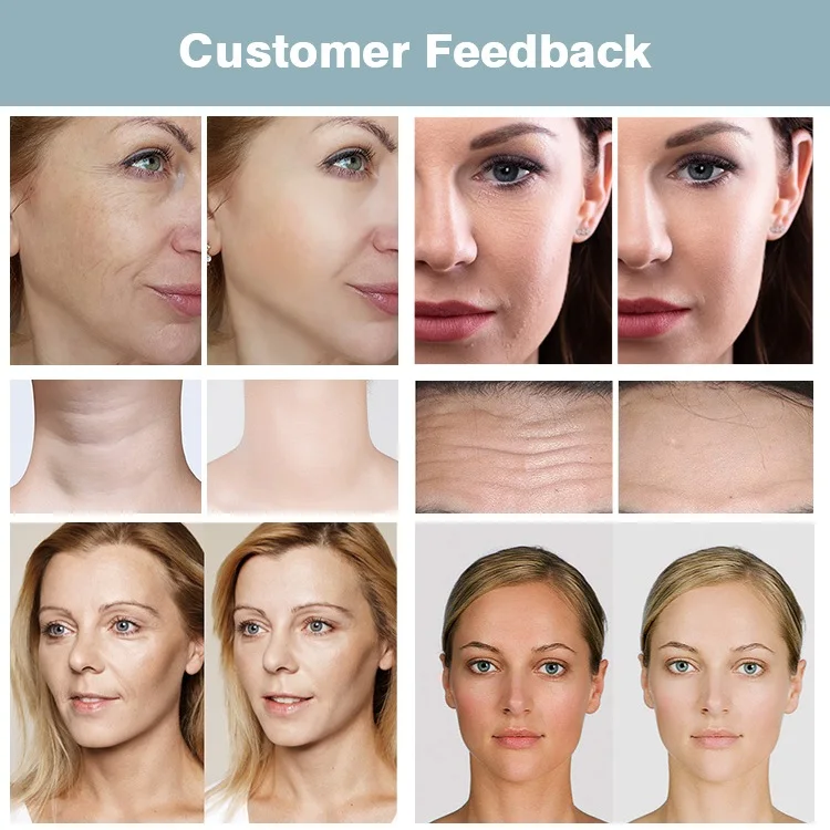 2023 New Arrive Anti-Aging Face Lifting Face Deep Care EMS Rf Fractional Rf Beauty Machine