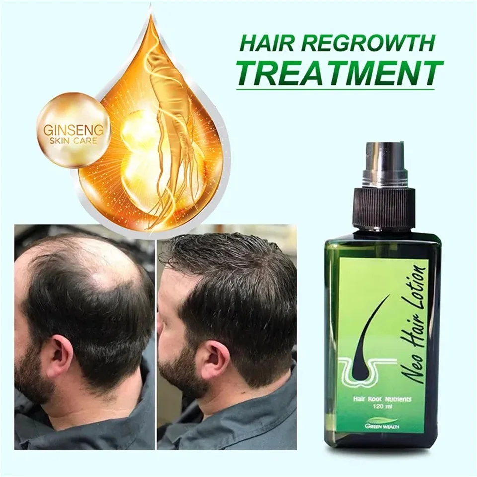 Neo Hair Lotion (4).jpg