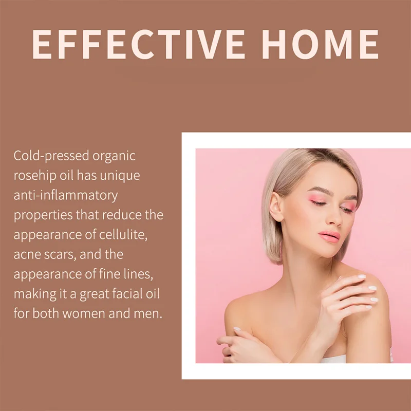 100% Natural Organic Rosehip Base Oil Pure Essential Oil Blend 118ml Volume OEM Supply Made From Plant Ingredients