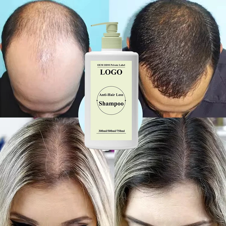 CHAOBA Natural Anti-Hair Loss Treatment Peppermint Hair Growth Shampoo and Conditioner Therapy with Rosemary Oils Biotin