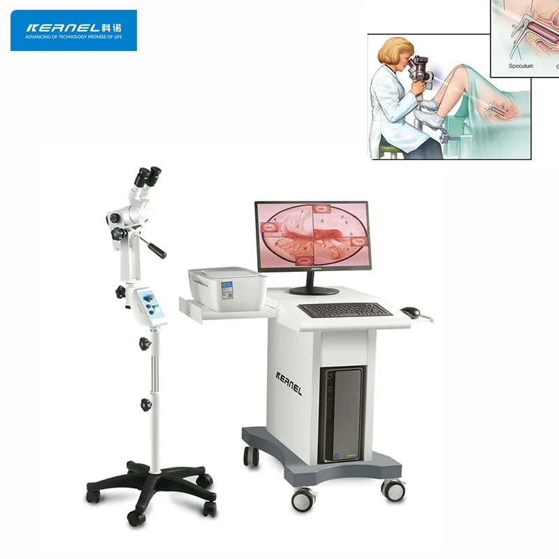 CE Approved Kernel Colposcope KN-2200BI Optical Colposcopy Colposcope for Gynecology