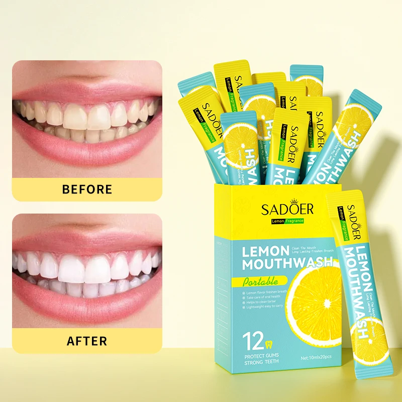 OEM SADOER private label mint peach lemon fragrance travel size oral care teeth whitening custom mouthwash