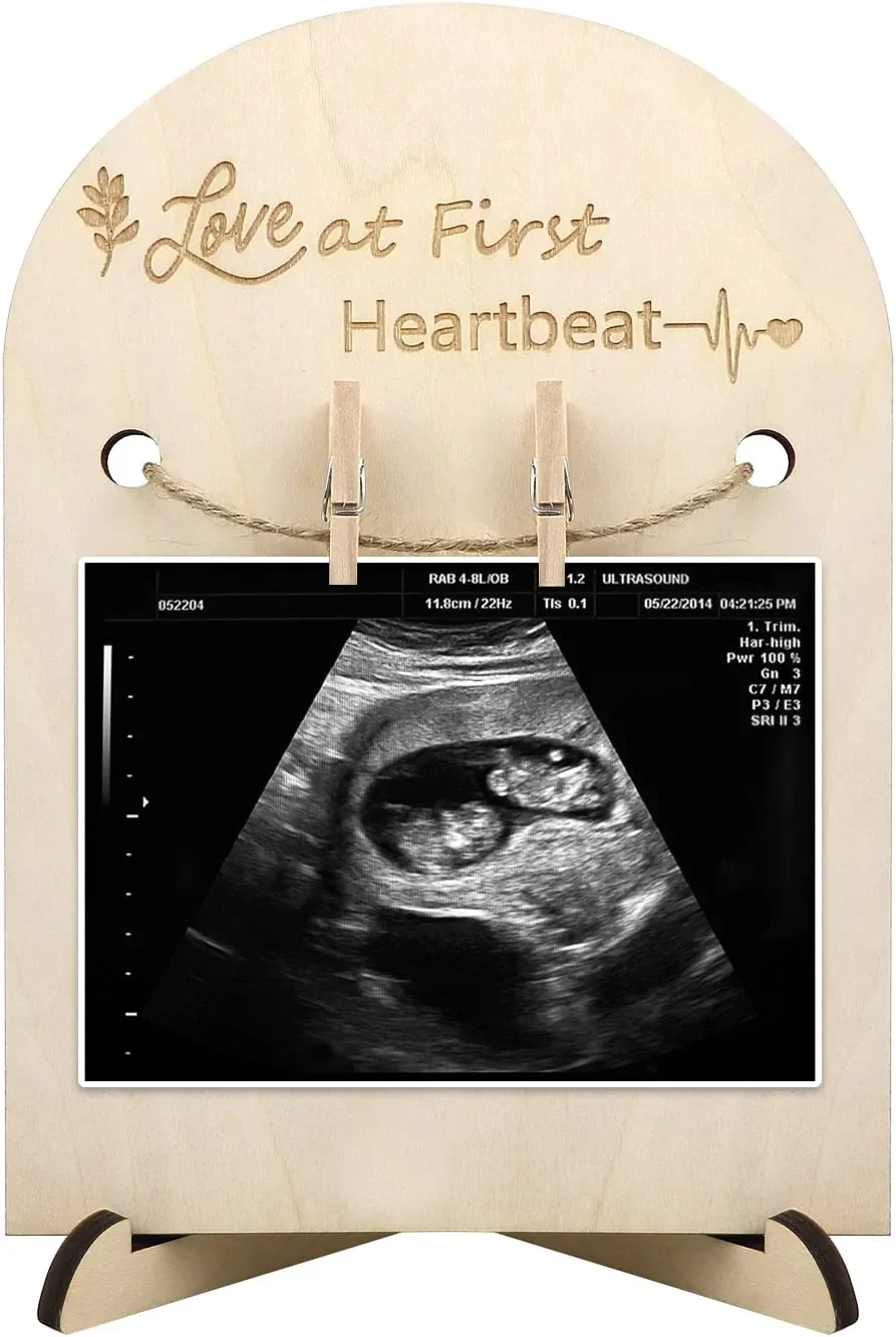 Customized Pregnancy Announcement Creative Baby Kindergarten decorative picture frame suitable for ultrasound photos