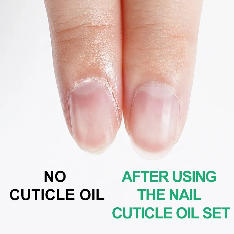 Private label nutrition oil revitalizer nail cuticle oil flower cuticle oil for nails