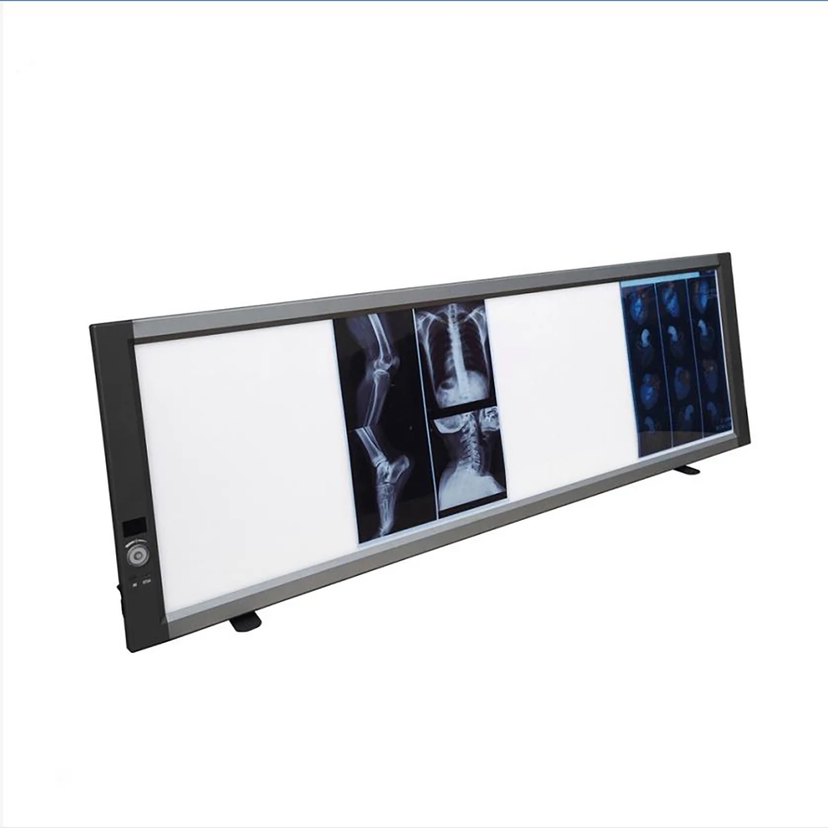 
China Quadruple Panel Medical LED X-ray Film Viewer X-ray Viewing Light MSLZG4C 