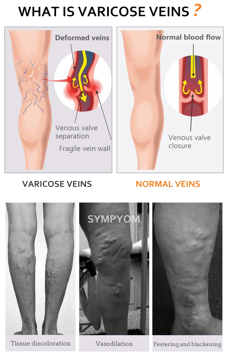 Compression Socks for Women Circulation 8-15mmHg Sheer Knee High Compression Stockings for Swelling, Arthritis, Varicose Veins