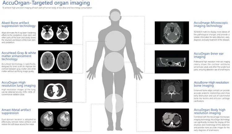 MY-D055J hospital instrument medical computed tomography ct scanner medical 16 slice ct machine price