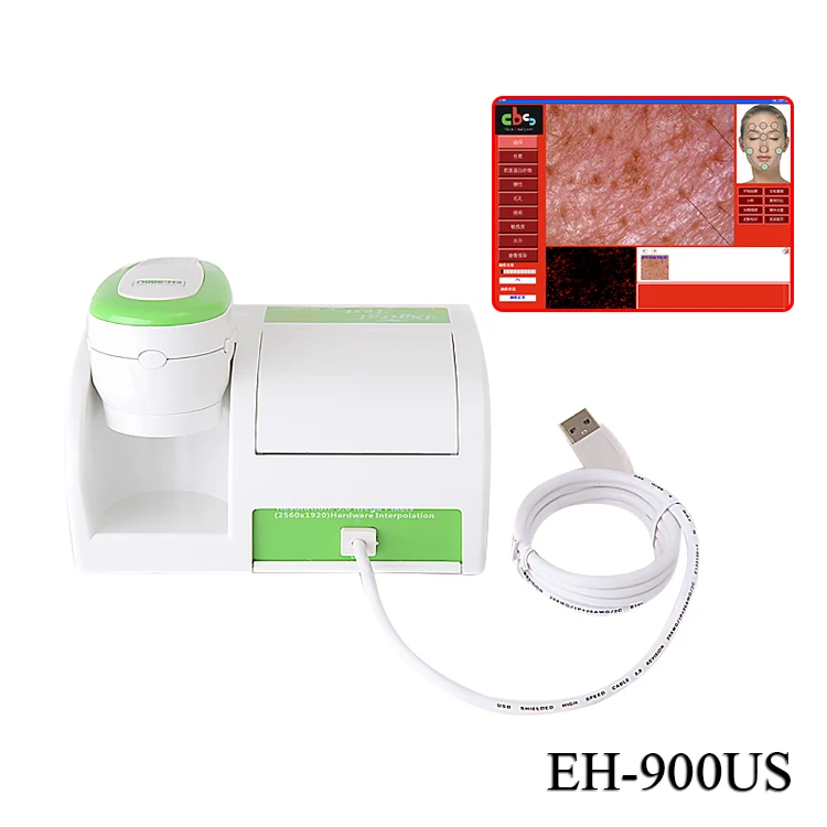 Portable 3 in 1 facial skin analyzer machine 3d oil acne pore scanner test analysis  facial skin analyzer