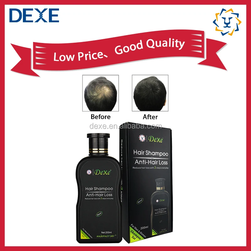 Name Brand Anti Hair Loss Shampoo India Adult ISO Male 10 Years Experience OEM ODM OBM Superior Accepted FT888-01