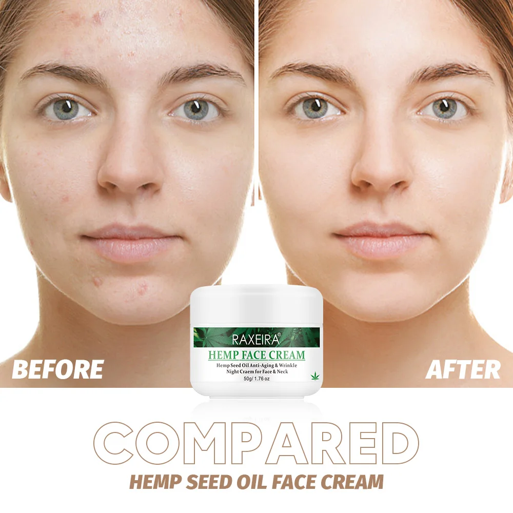 Hemp Seed Oil Anti-Aging & Wrinkle Night Cream for Face & Neck