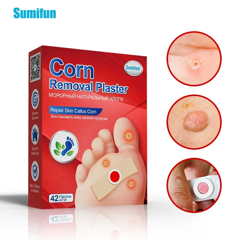 Rehabilitation treatment supplies health medical corn paste foot callus ointment