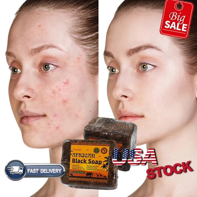 Wholesale private label 100% hand made natural organic ghana raw african black soap