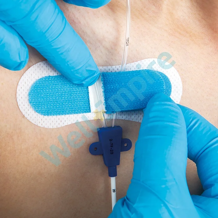 
G7 Foley Dressing Epidural Methods Umbilical Catheter Fixation 