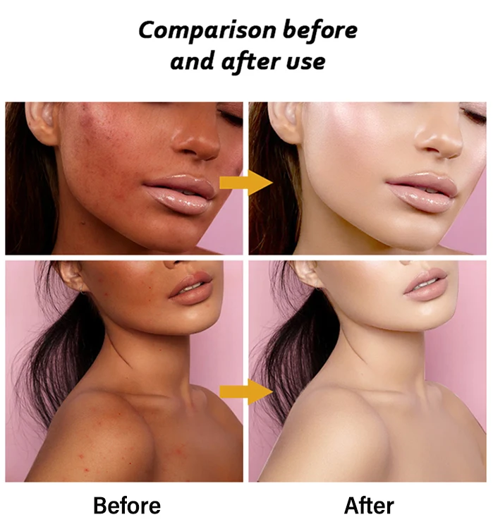 Natural Skincare Set Anti Aging Facial Body Ladies Beauty Rejuvenating Glutathione Whitening Brightening Skin Care Set