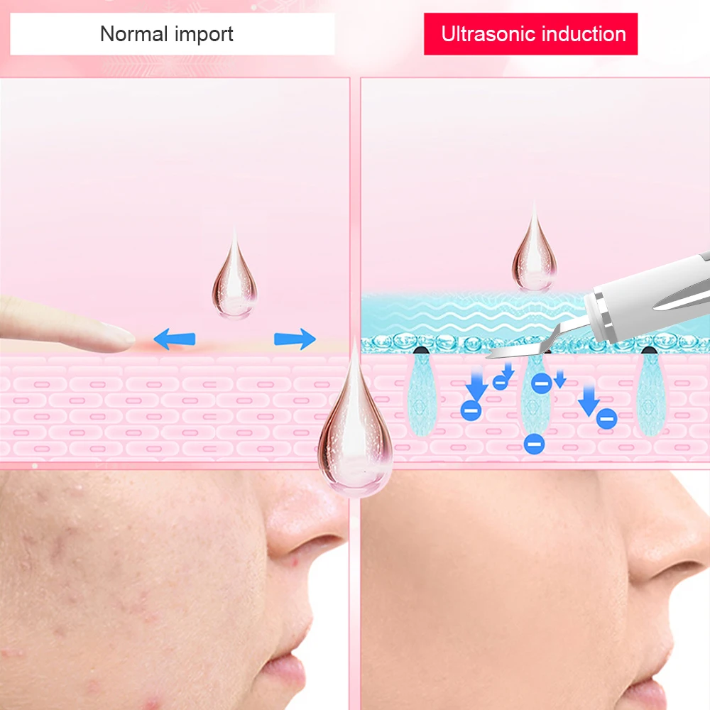 New Version Upgraded Portable Professional Ion Spatula  Wireless Ultrasonic Face Massager Cleaner Skin Scrubber For Face