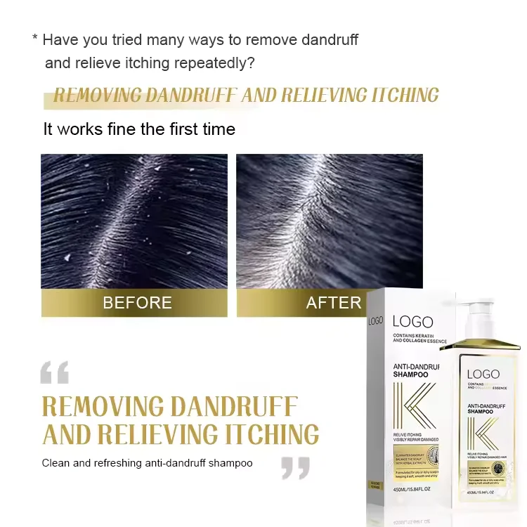 Private Label Factory Wholesale Weakly Acidic Keratin Collagen Organic Anti Dandruff Shampoo