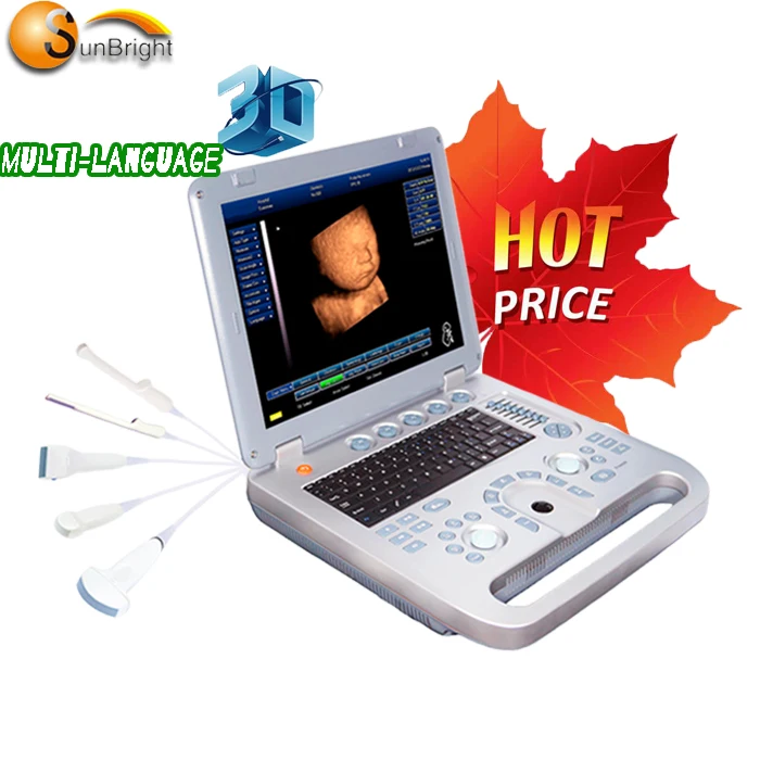 Лучшая цена SUN-800D ноутбук больница Цветной Допплер ультразвуковой сканер 3D 4D ультразвука