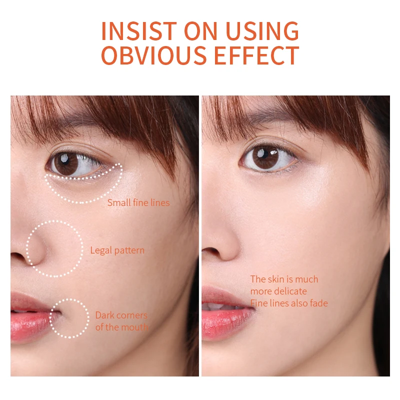 Private label Retinol Hyaluronic Acid anti wrinkle Moisturizer serum skin care face capsule face cream