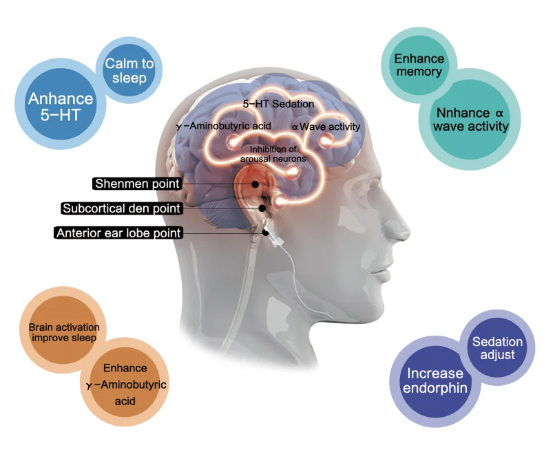 CES Alpha Stim Therapy Device Insomnia Anxiety Depression CES Therapy Device Sleeping Aid Device With No Side Effect