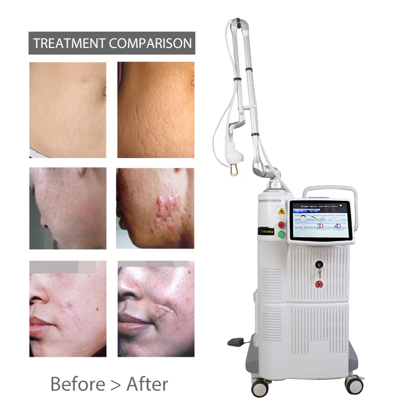 High Quality And Best Price Vaginal Tightening Treatment Resurfacing Fractional Co2 Laser With Cooling