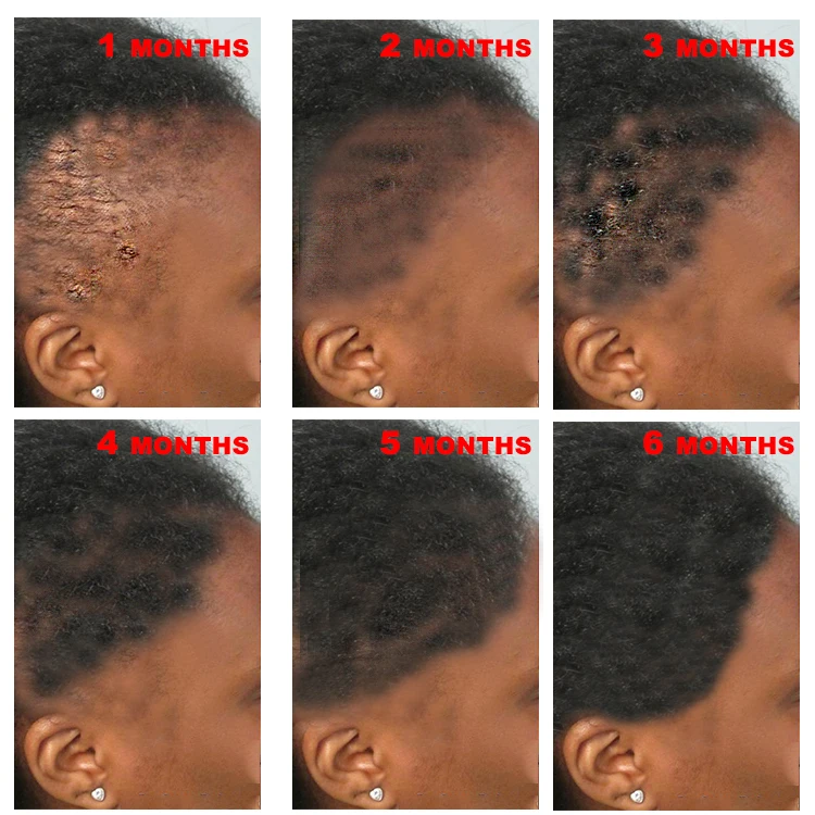 Private Label Natural Organic Hair Care Loss Treatment Serum Anti Hair Loss Promote Hair Growth 7 Days Ginger Essential Oil