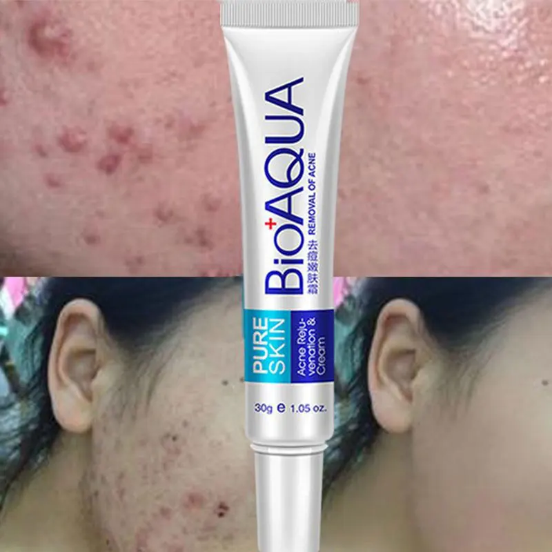 Hot selling Scars Removal Face Cream Light Print Beauty Pure Skin Care Whitening Facial Moisturizing Cream Acne Treatment Cream