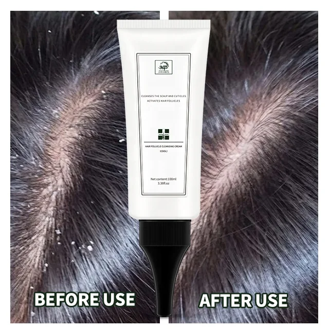 PRE-WASH SCALP EXFOLIANT SCALP DETOX PRODUCTS SCALP CLEANSING CREAM TO CLEAN HAIR FOLLICLES AND REFRESHING  FOR ADULT