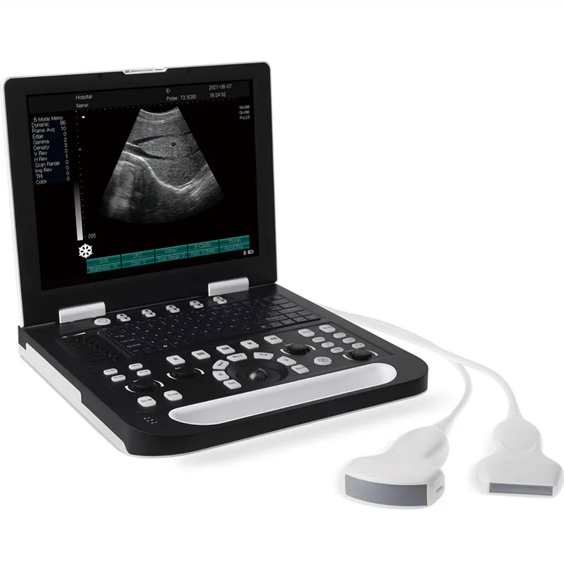 Sonoscape Portable Laptop 2D black and white Ultrasound Scanner Machine for Veterinary and Human