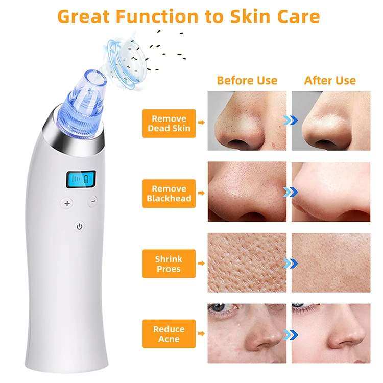 New Face Mini Skin Electric Tool With Vacuum Suction Kits Pore Cleaner Machine Beauty Vacuum Blackhead Remover